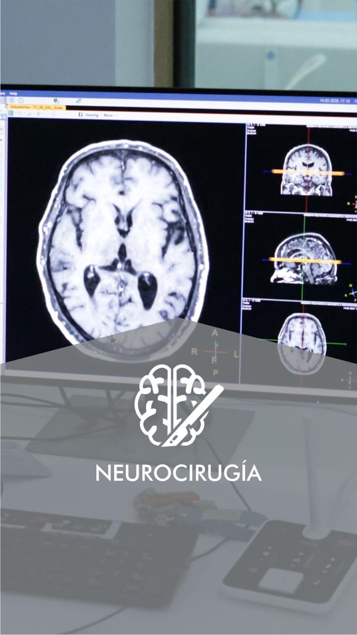 Neurocirugía